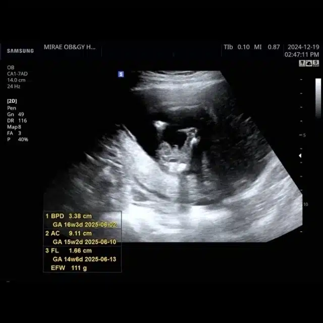 0003900661 003 20250102133015599